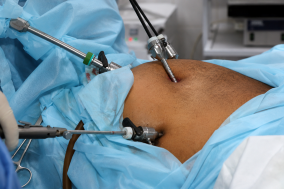 Thyroid Surgery