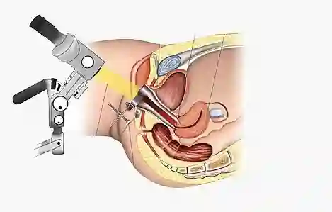 Colposcopy