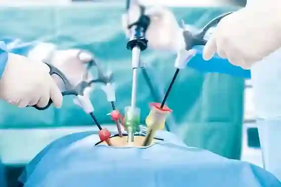 Surgery
