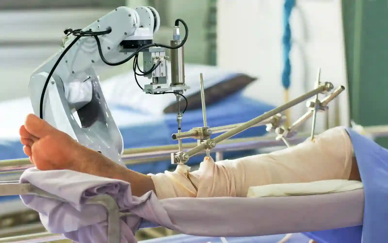Arthroscopy